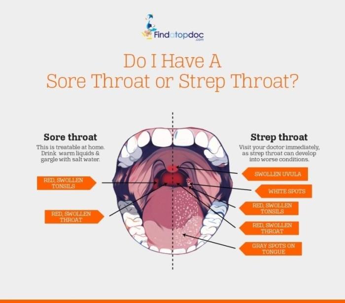 Sore throat or strep throat quiz