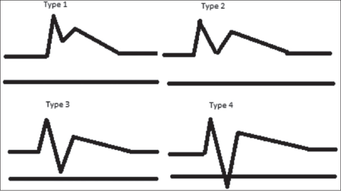 Artery vertebral subclavian ultrasound doppler steal flow waveform stenosis syndrome velocity forward medicina