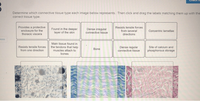 Determine which connective tissue type each image below represents