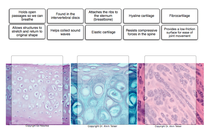 Determine which connective tissue type each image below represents